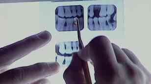Doble cadena