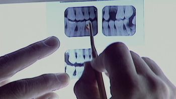 Doble cadena