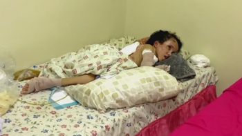 Joven con hidrocefalia por poco muere en un incendio: sufrió quemaduras y su familia pide ayuda