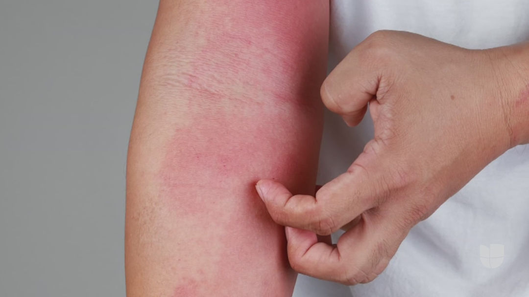 Estos síntomas en la piel pueden ser señales de alguna enfermedad: un doctor da recomendaciones | ViX