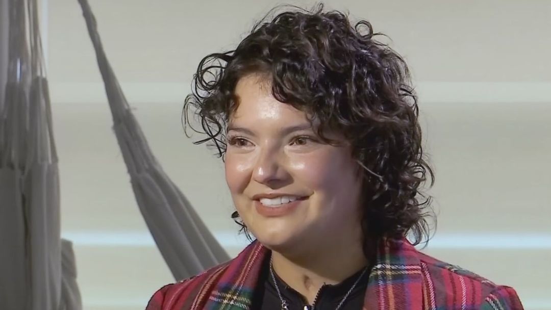 Bailarina hispana que terminó en llamas en un show cuenta su lucha para recuperarse: "Es un milagro" | ViX