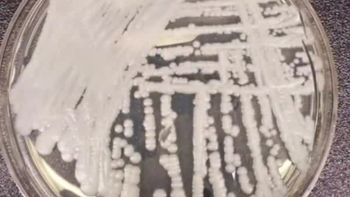 Un hongo mortal y resistente a medicamentos se propaga con rapidez en EEUU: hay 27 estados afectados