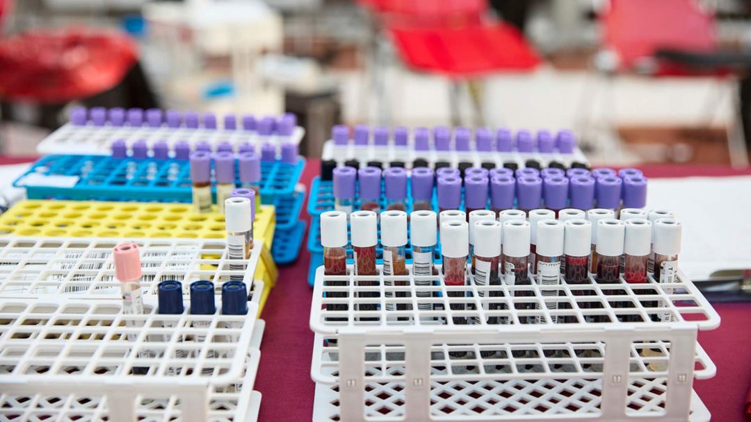 Hay escasez de sangre en Estados Unidos: Cruz Roja | ViX