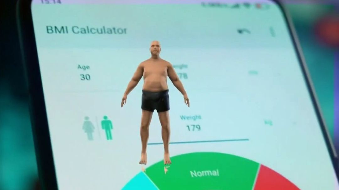 ¿Cómo formar un plato saludable para combatir la obesidad? Doctor da recomendaciones | ViX