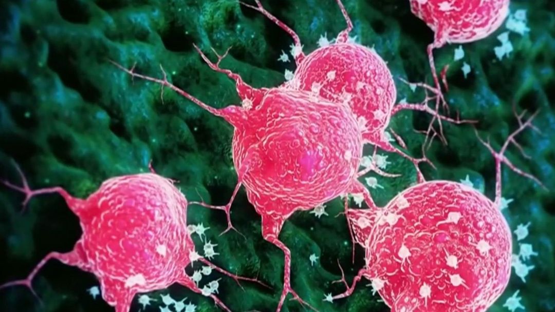 Día mundial contra el cáncer: ¿Qué factores puedo controlar en mi entorno y que ayudan a prevenir la enfermedad? | ViX