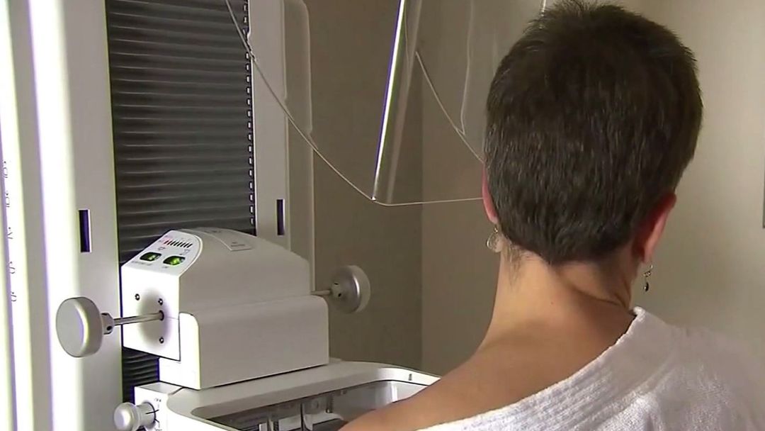 “Vivimos con miedo a la recurrencia”: mujeres narran cómo es la vida después de un diagnóstico de cáncer | ViX