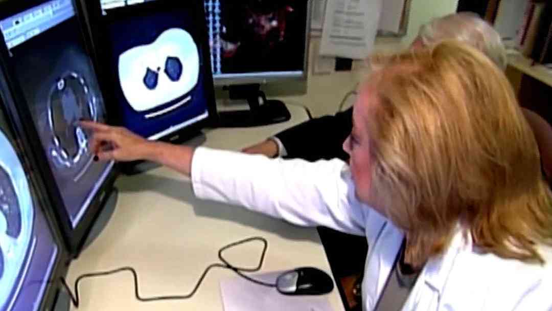 Tratamiento contra el cáncer antes de las 3:00 PM podría alargar la vida casi un año | ViX