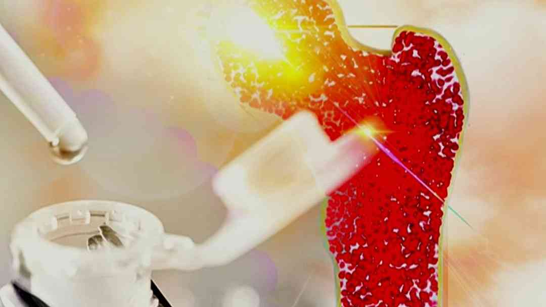 El caso viral de Max y la donación de médula ósea ¿Por qué es difícil hallar donantes para hispanos? | ViX