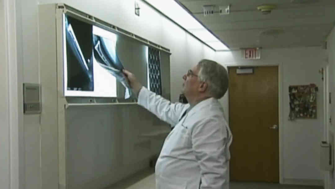 ¿Cómo podrían afectar al cuerpo los medicamentos para perder peso? Lanzan alerta por riesgos para salud ósea | ViX