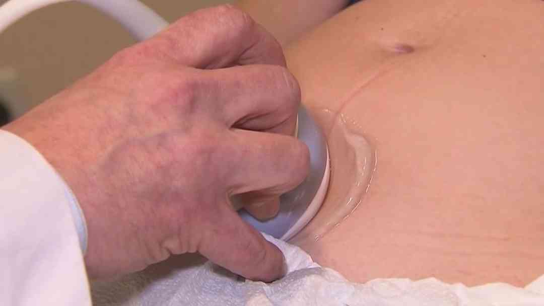 ¿Por qué bajó el consumo de acetaminofén en embarazadas? Doctor habla sobre dudas del fármaco | ViX