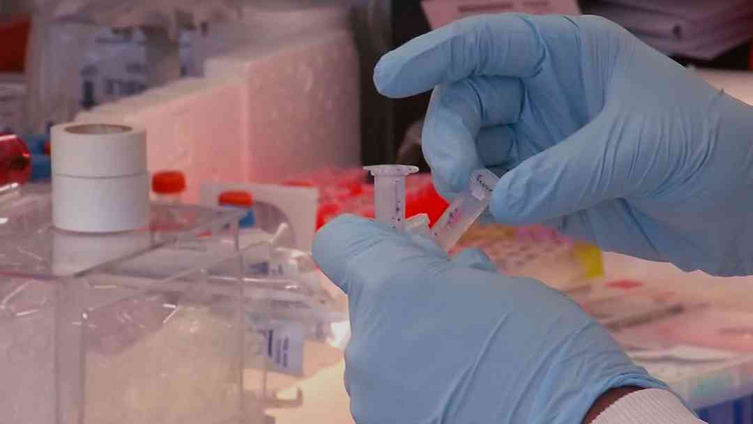IA detecta cáncer de páncreas hasta tres años antes, revela estudio de Clínica Mayo | ViX