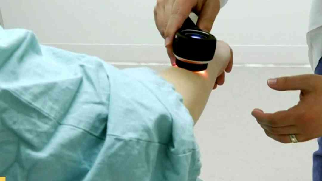 ¿Cáncer de piel se puede detectar con IA? ¿Qué tecnología y veracidad tiene este procedimiento? | ViX
