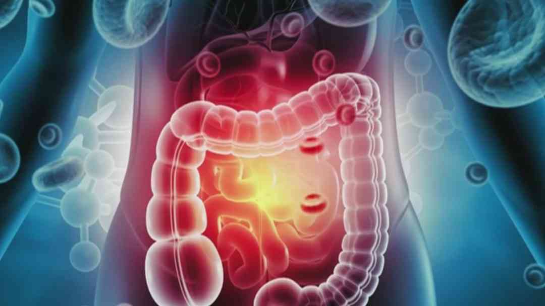 Nuevas pruebas de sangre facilitan la detección del cáncer colorrectal | ViX