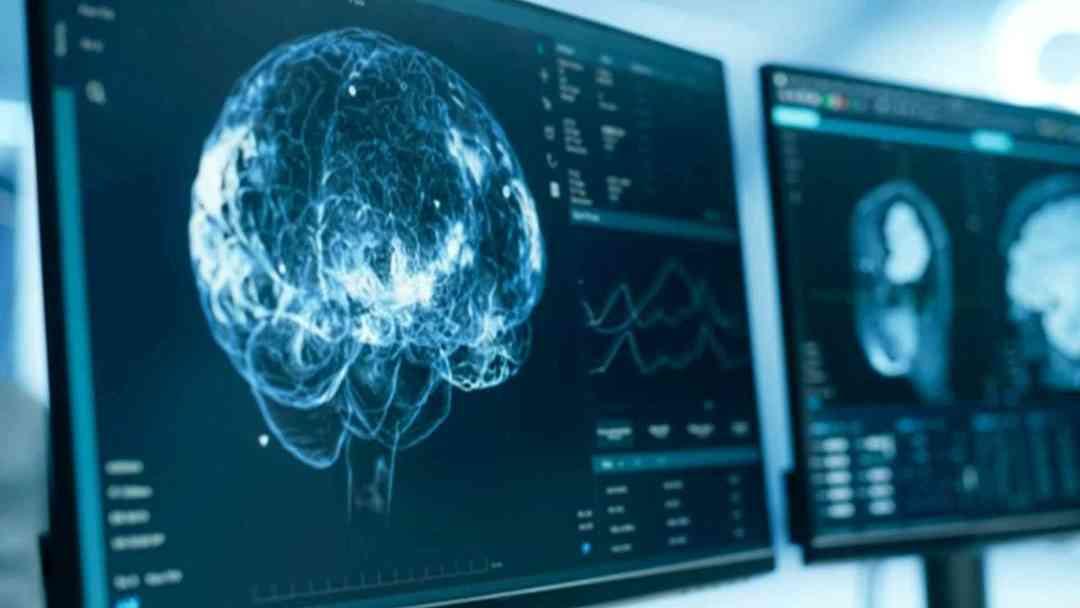 ¿Cómo se puede alentar el envejecimiento del cerebro y mantenerlo joven? | ViX