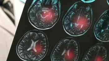 Cenar cuatro horas antes de dormir ayuda a prevenir el deterioro cognitivo en adultos mayores