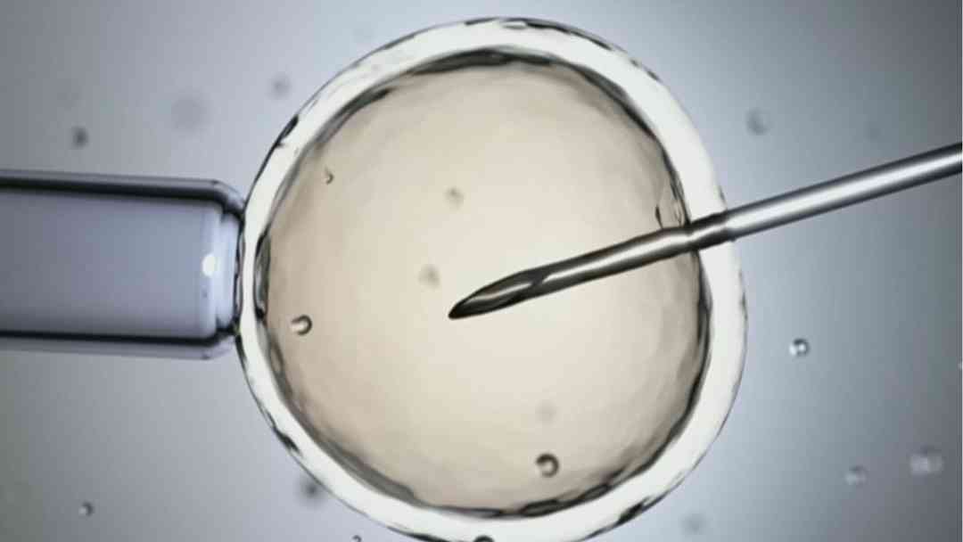 ¿Por qué cada vez son más los estadounidenses que buscan tratamientos de fertilidad en el extranjero? Especialista analiza | ViX